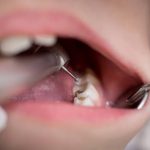 Choosing the Right Dentist in Brentwood for Your Dental Needs